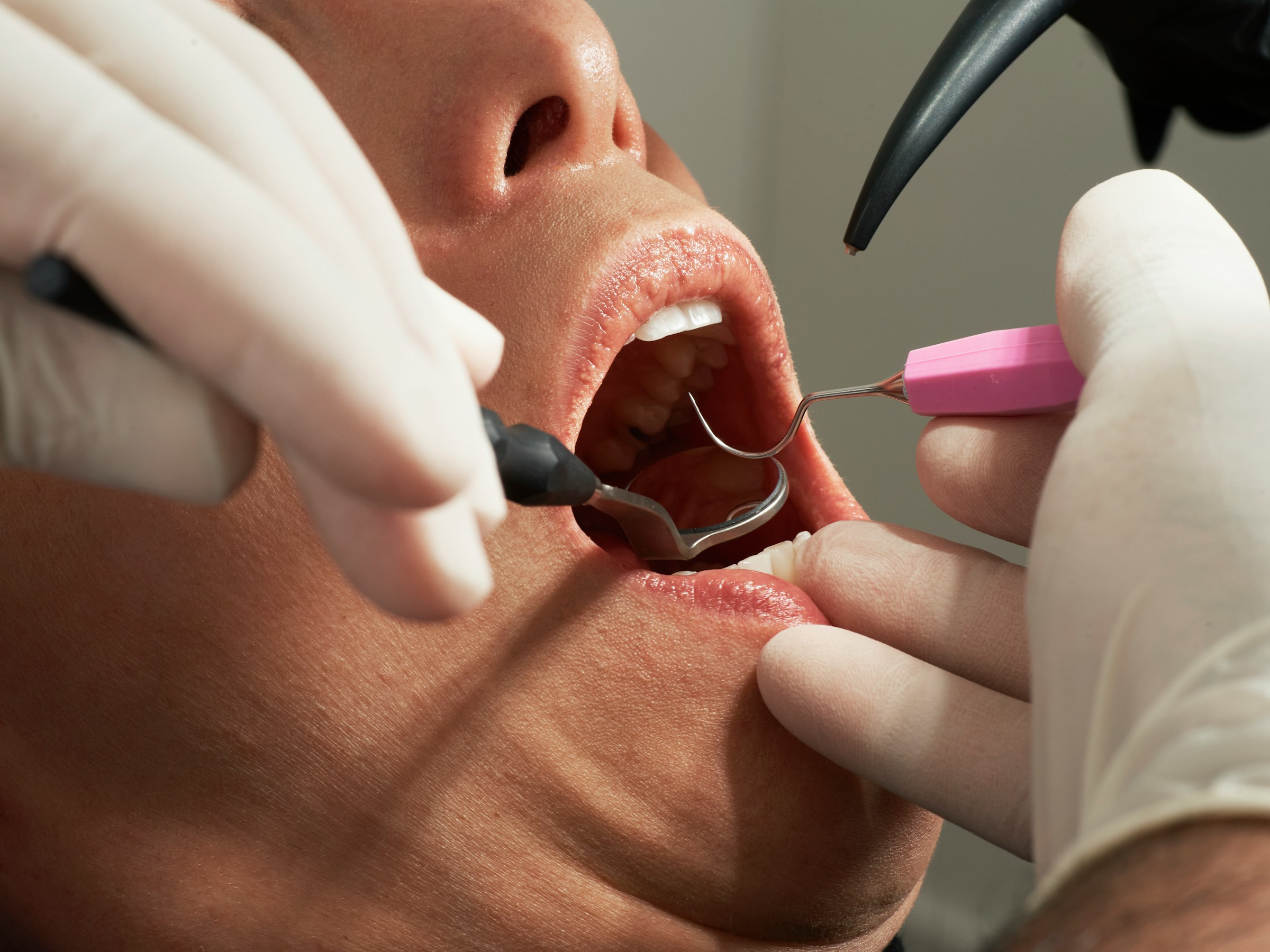 Prenez contact avec un dentiste de Noisy-le-Sec grâce à info-dentistes.fr